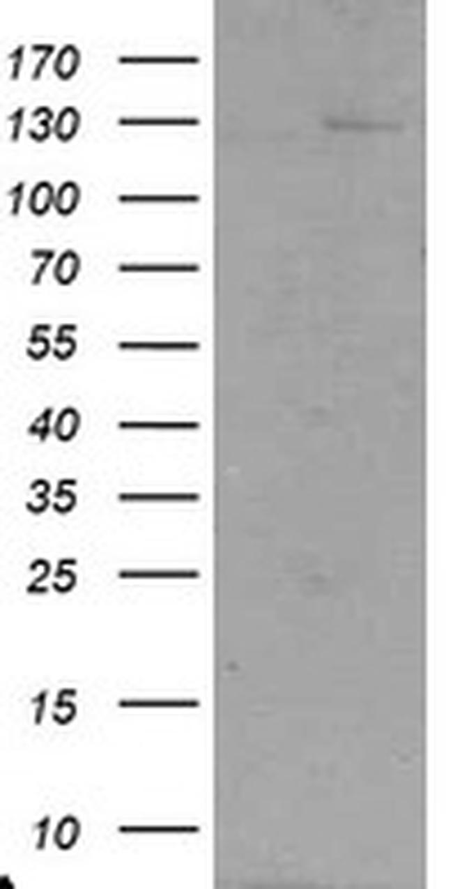 USP36 Antibody in Western Blot (WB)