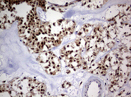 USP44 Antibody in Immunohistochemistry (Paraffin) (IHC (P))