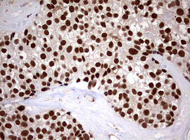 USP44 Antibody in Immunohistochemistry (Paraffin) (IHC (P))