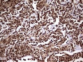 USP44 Antibody in Immunohistochemistry (Paraffin) (IHC (P))