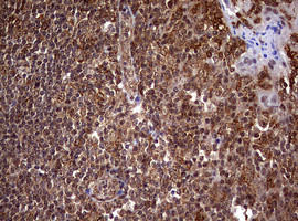 USP44 Antibody in Immunohistochemistry (Paraffin) (IHC (P))