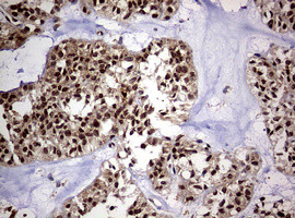 USP44 Antibody in Immunohistochemistry (Paraffin) (IHC (P))