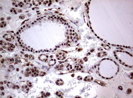 USP44 Antibody in Immunohistochemistry (Paraffin) (IHC (P))