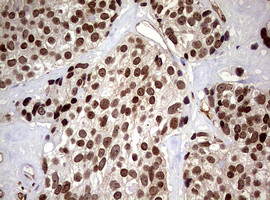 USP44 Antibody in Immunohistochemistry (Paraffin) (IHC (P))