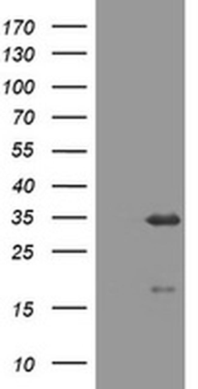 USP44 Antibody in Western Blot (WB)