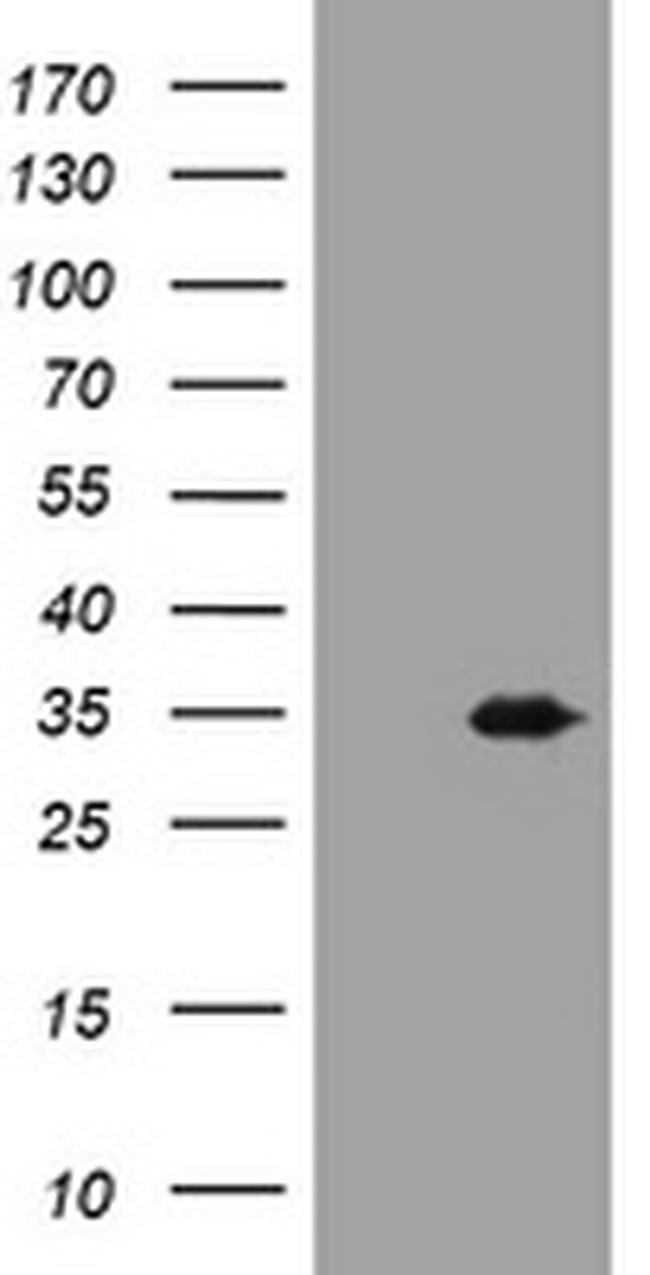 USP44 Antibody in Western Blot (WB)