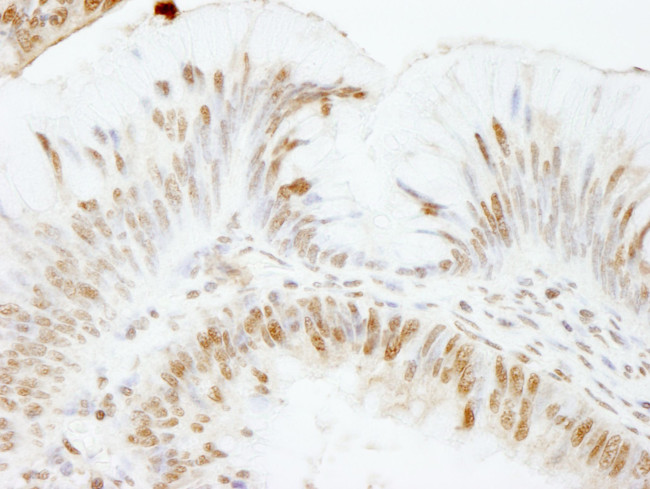 USP47 Antibody in Immunohistochemistry (IHC)