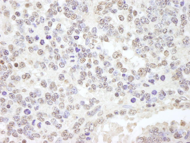 USP47 Antibody in Immunohistochemistry (IHC)