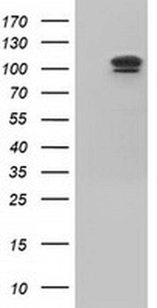 USP5 Antibody in Western Blot (WB)