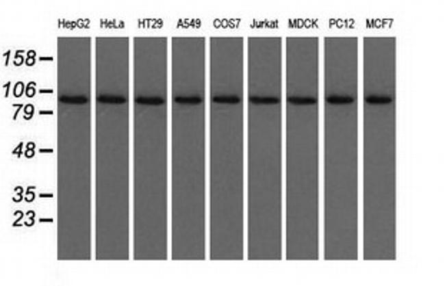 USP5 Antibody in Western Blot (WB)