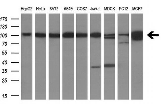 USP5 Antibody in Western Blot (WB)