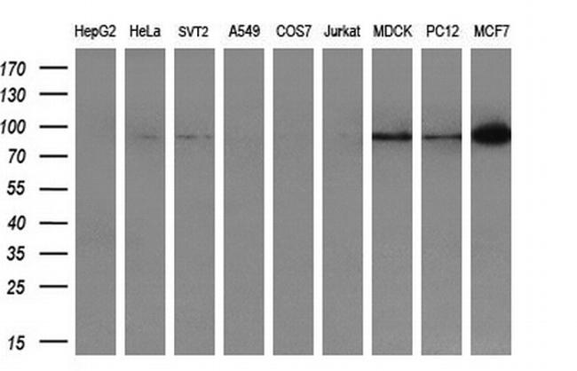 USP5 Antibody in Western Blot (WB)