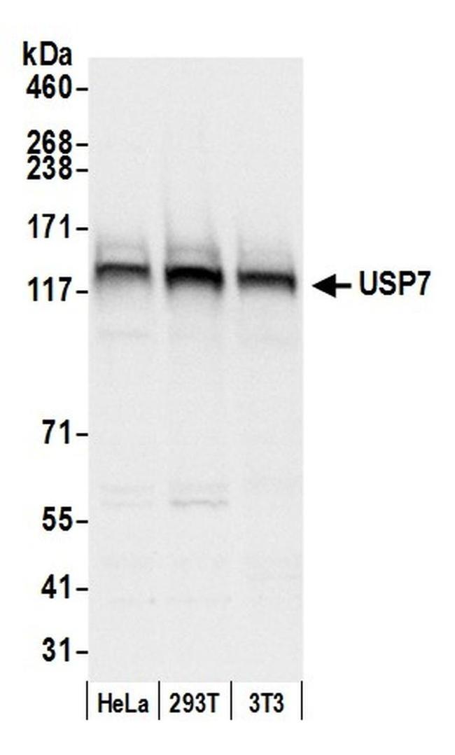 USP7 Antibody in Western Blot (WB)