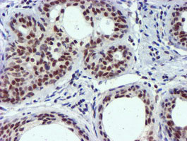 USP7 Antibody in Immunohistochemistry (Paraffin) (IHC (P))