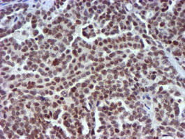 USP7 Antibody in Immunohistochemistry (Paraffin) (IHC (P))