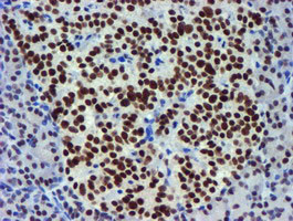 USP7 Antibody in Immunohistochemistry (Paraffin) (IHC (P))