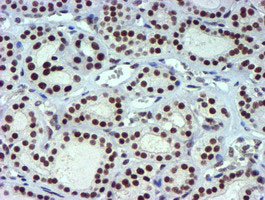 USP7 Antibody in Immunohistochemistry (Paraffin) (IHC (P))