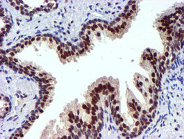 USP7 Antibody in Immunohistochemistry (Paraffin) (IHC (P))