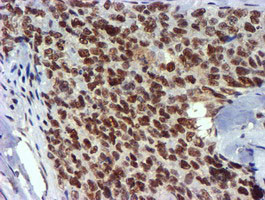 USP7 Antibody in Immunohistochemistry (Paraffin) (IHC (P))