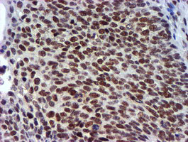 USP7 Antibody in Immunohistochemistry (Paraffin) (IHC (P))