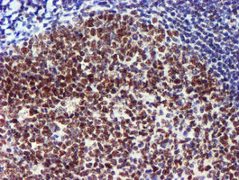 USP7 Antibody in Immunohistochemistry (Paraffin) (IHC (P))