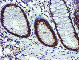 USP7 Antibody in Immunohistochemistry (Paraffin) (IHC (P))