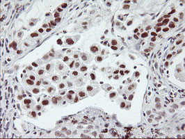 USP7 Antibody in Immunohistochemistry (Paraffin) (IHC (P))