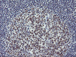 USP7 Antibody in Immunohistochemistry (Paraffin) (IHC (P))