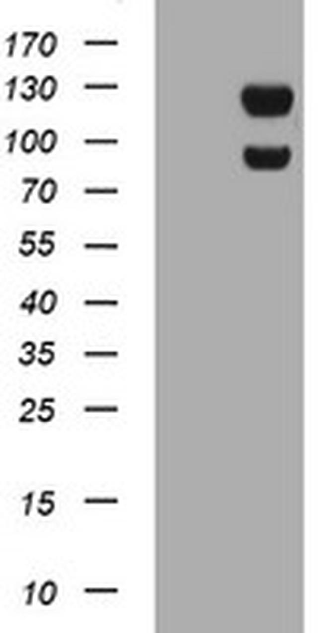 USP7 Antibody in Western Blot (WB)