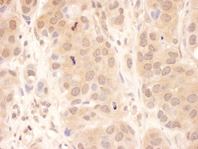 USP8 Antibody in Immunohistochemistry (IHC)