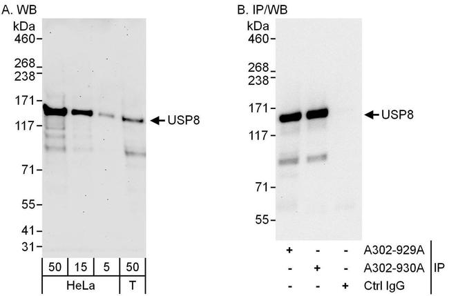 USP8 Antibody in Western Blot (WB)