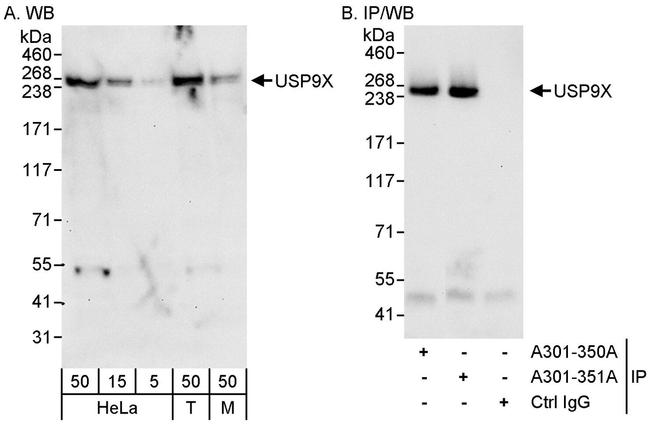 USP9X Antibody in Western Blot (WB)