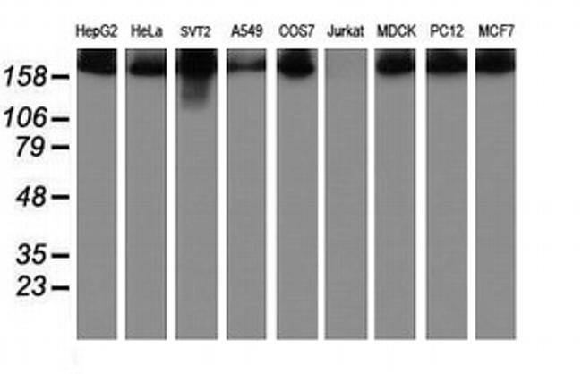 USP9X Antibody in Western Blot (WB)