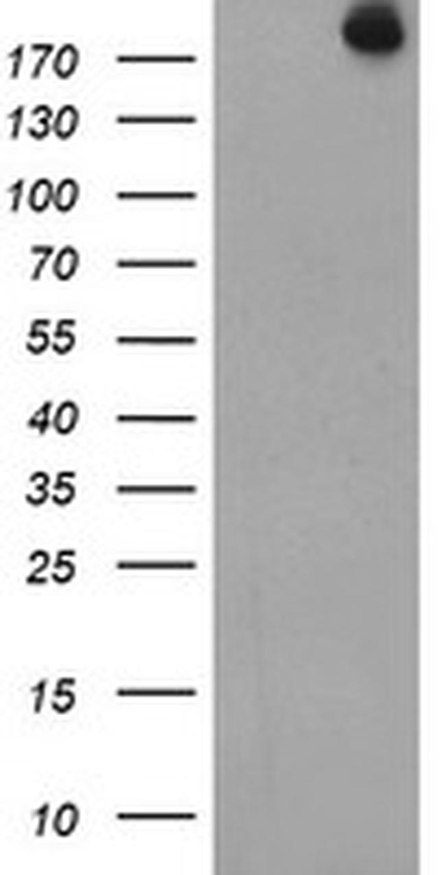 USP9X Antibody in Western Blot (WB)