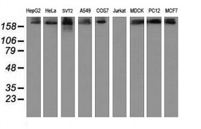 USP9X Antibody in Western Blot (WB)