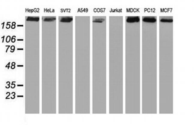 USP9X Antibody in Western Blot (WB)