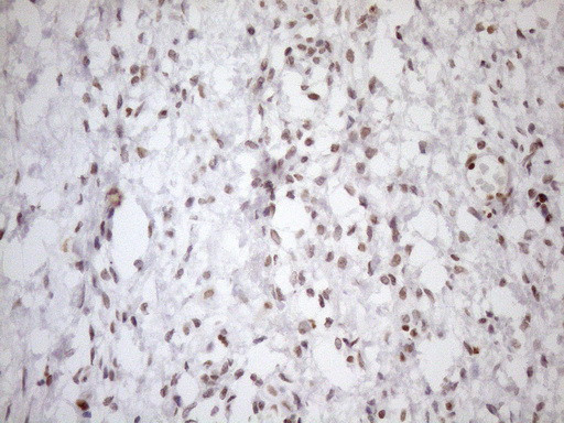 UTP11L Antibody in Immunohistochemistry (Paraffin) (IHC (P))