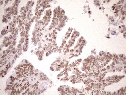 UTP11L Antibody in Immunohistochemistry (Paraffin) (IHC (P))