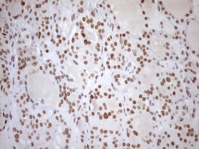 UTP11L Antibody in Immunohistochemistry (Paraffin) (IHC (P))