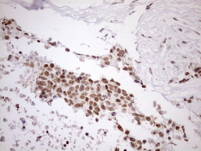 UTP11L Antibody in Immunohistochemistry (Paraffin) (IHC (P))