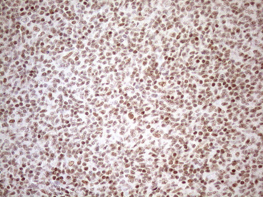 UTP11L Antibody in Immunohistochemistry (Paraffin) (IHC (P))