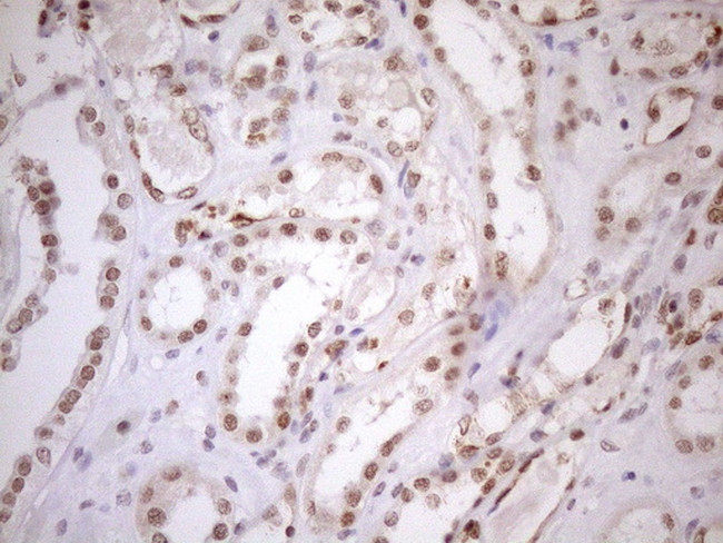 UTP11L Antibody in Immunohistochemistry (Paraffin) (IHC (P))