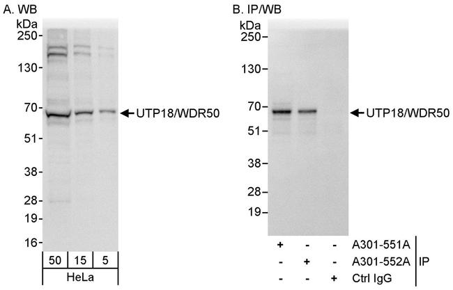 UTP18/WDR50 Antibody in Western Blot (WB)