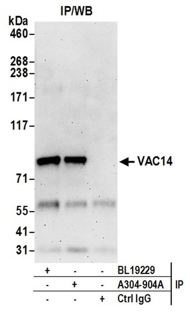 VAC14 Antibody in Western Blot (WB)