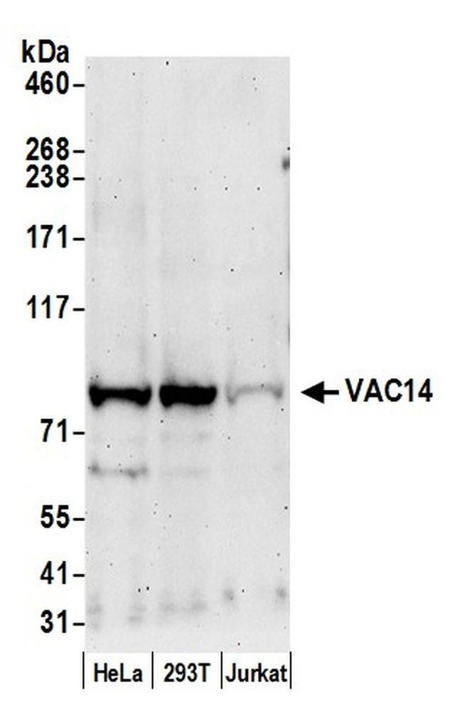 VAC14 Antibody in Western Blot (WB)