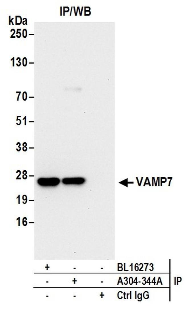 VAMP7 Antibody in Western Blot (WB)