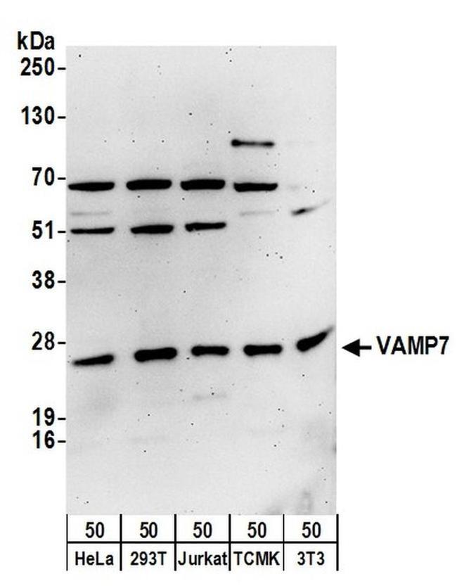 VAMP7 Antibody in Western Blot (WB)