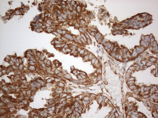 VAPA Antibody in Immunohistochemistry (Paraffin) (IHC (P))