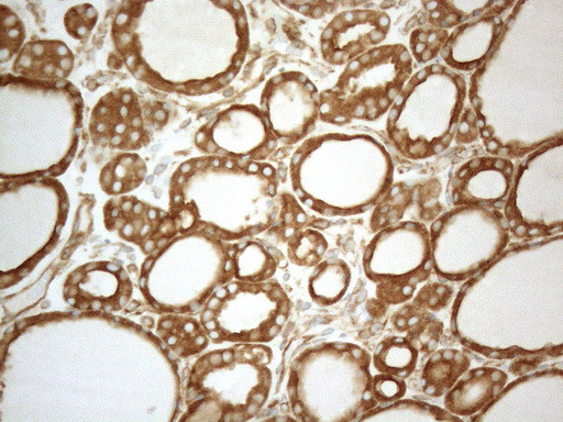 VAPA Antibody in Immunohistochemistry (Paraffin) (IHC (P))