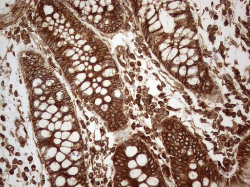 VAPA Antibody in Immunohistochemistry (Paraffin) (IHC (P))